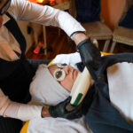 Pixel RF laser procedure facial treatment performed on patron of Laser & Wellness Center.