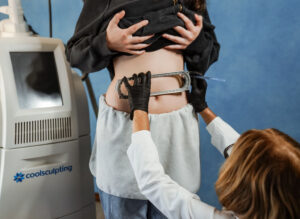 Accent Skin Tightening performed on stomach of Laser & Wellness Center patient as she stands next to CoolSculpting machinery.