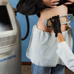 Accent Skin Tightening performed on stomach of Laser & Wellness Center patient as she stands next to CoolSculpting machinery.