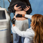 Accent Skin Tightening performed on stomach of Laser & Wellness Center patient as she stands next to CoolSculpting machinery.